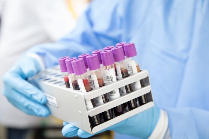 Dłonie laborantki trzymające próbki badanej krwi.